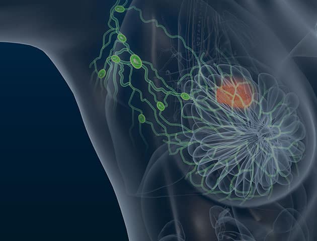 Vorschaubild des Gen-Panels zur Diagnose erblich bedingter Tumorerkrankungen